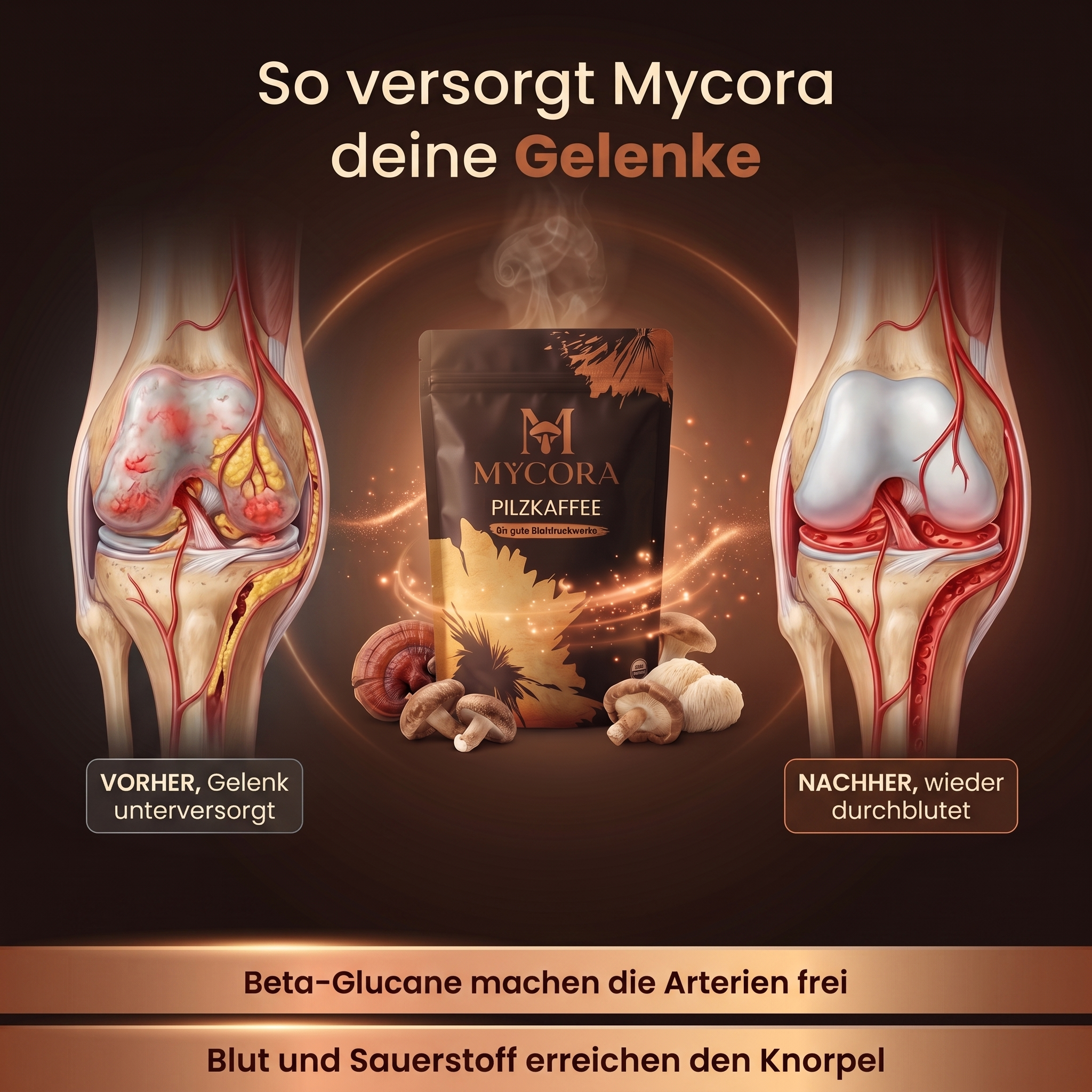 MYCORA™ Pilzkaffee