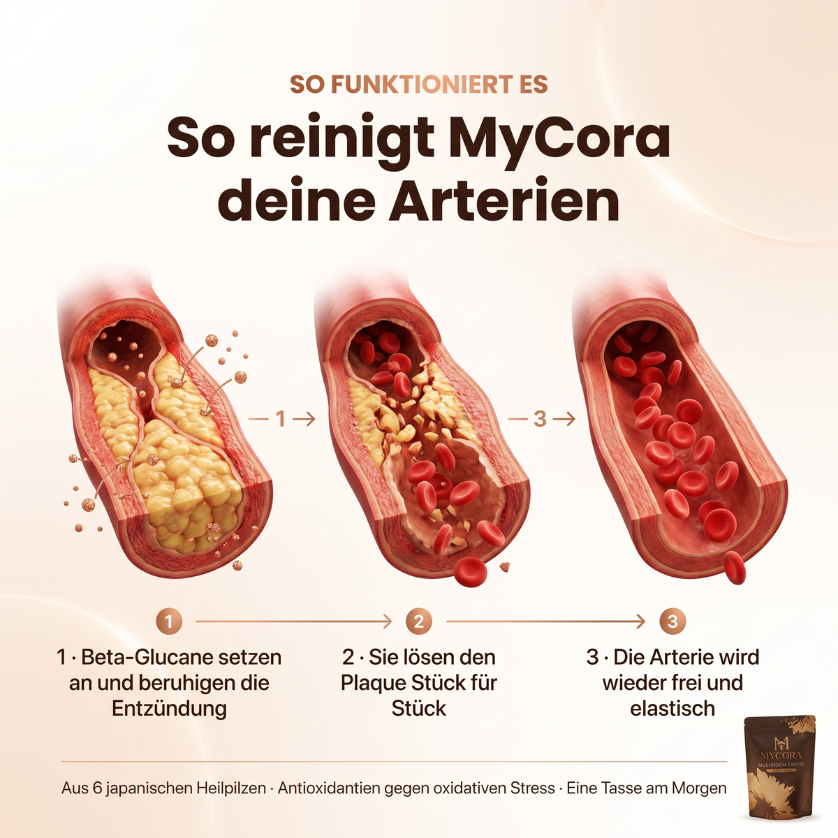 MYCORA™ Pilzkaffee
